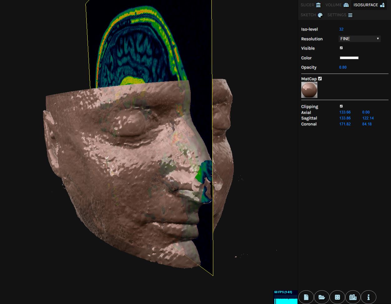 GitHub - sangkunine/MedicalWorks: A WebGL-based 3D Medical Solution