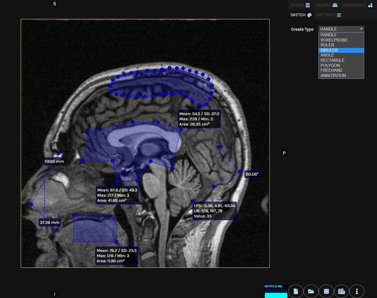GitHub - sangkunine/MedicalWorks: A WebGL-based 3D Medical Solution